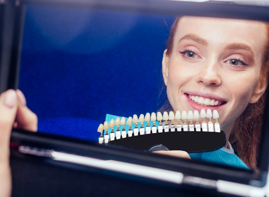 Digital Smile Design